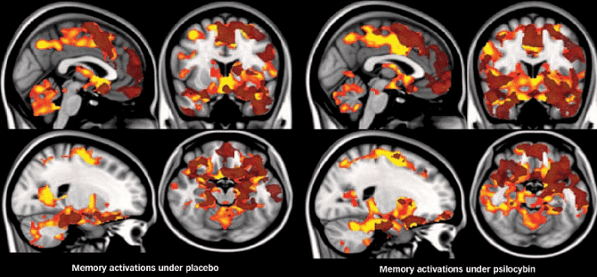 hyperconnected brain mushrooms -What are psychedelic hallucinations?