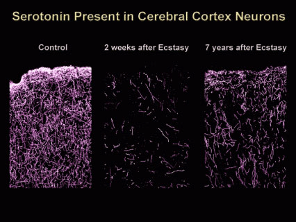 agotamiento de la serotonina